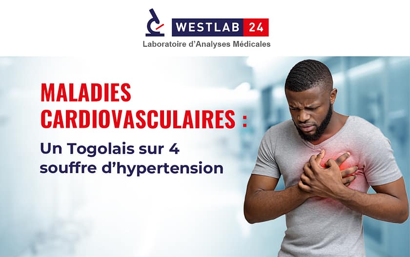 maladies_cardiovasculaires_hypertension_artérielle